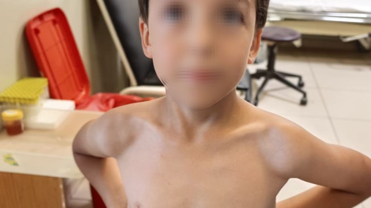 7 yaşındaki Mustafa'nın göğsüne kene yapıştı